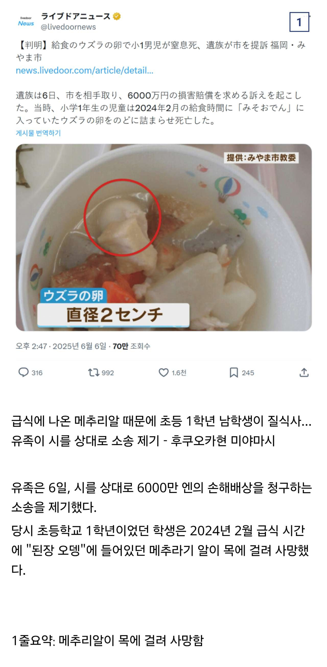 일본 톱 뉴스...급식 먹다가 목에 걸려서 사망