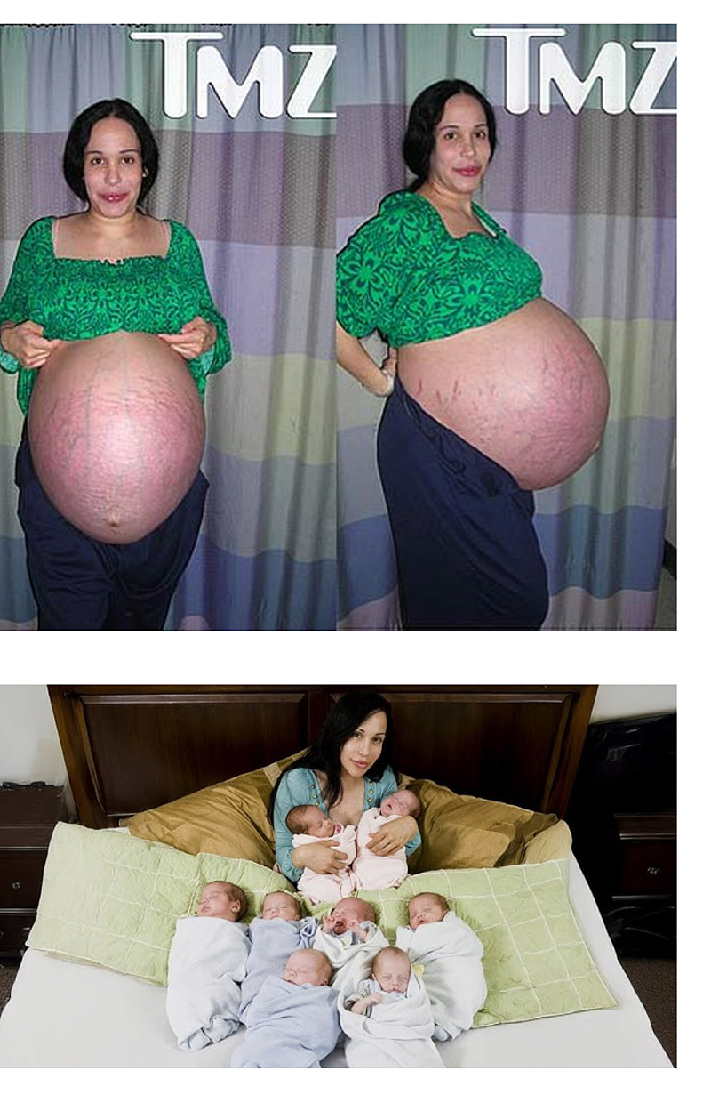 여덟 쌍둥이 낳은 엄마 근황